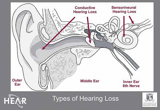 The hearing system